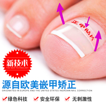 Hecai Zhengjia patch nail groove embedded nail corrector Special nail clippers for standing toes Cut long meat lira pull set inflammation