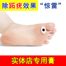 Physical store special plantar wart paste meat thorn paste Foot plantar wart paste Foot meat thorn paste cocoon corne paste to remove the soles of the feet
