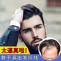 Mens hairline high patch forehead replacement film M-type full real hair replacement block invisible realistic wig film