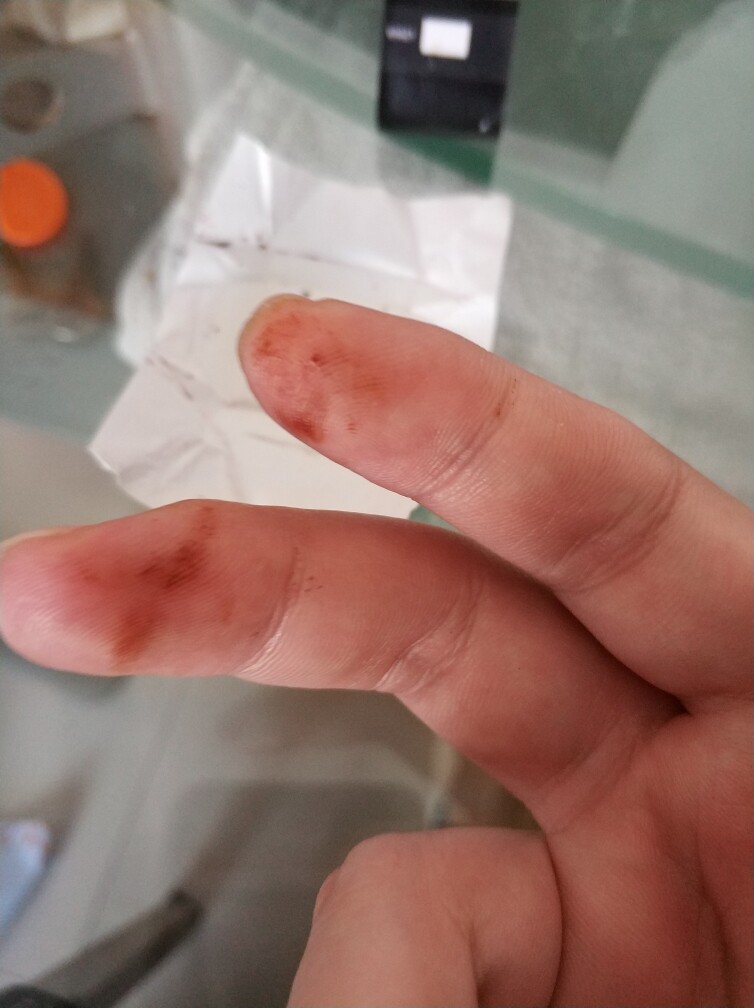 法国赛梦纯黑巧克力怎么样？效果好吗？明星同款使用后评价_搜券