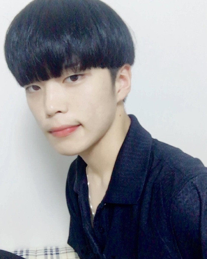 单眼皮/内双 肿眼泡