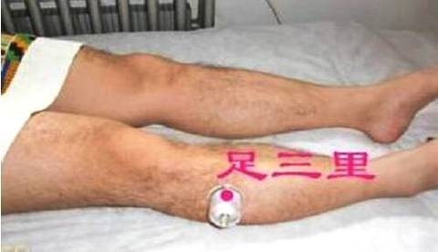 拔罐到底能不能去湿气?