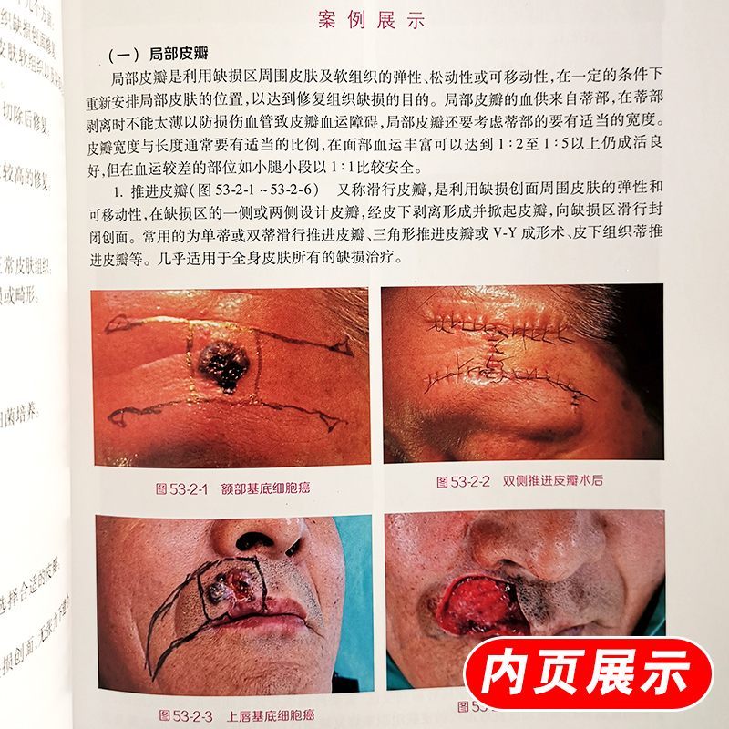 实用美容皮肤科学 何黎 郑志忠 周展超 主编 皮肤美容参考书 皮肤 美容医学 实用美容皮肤科学 皮肤激光医学与美容 人民卫生出版社