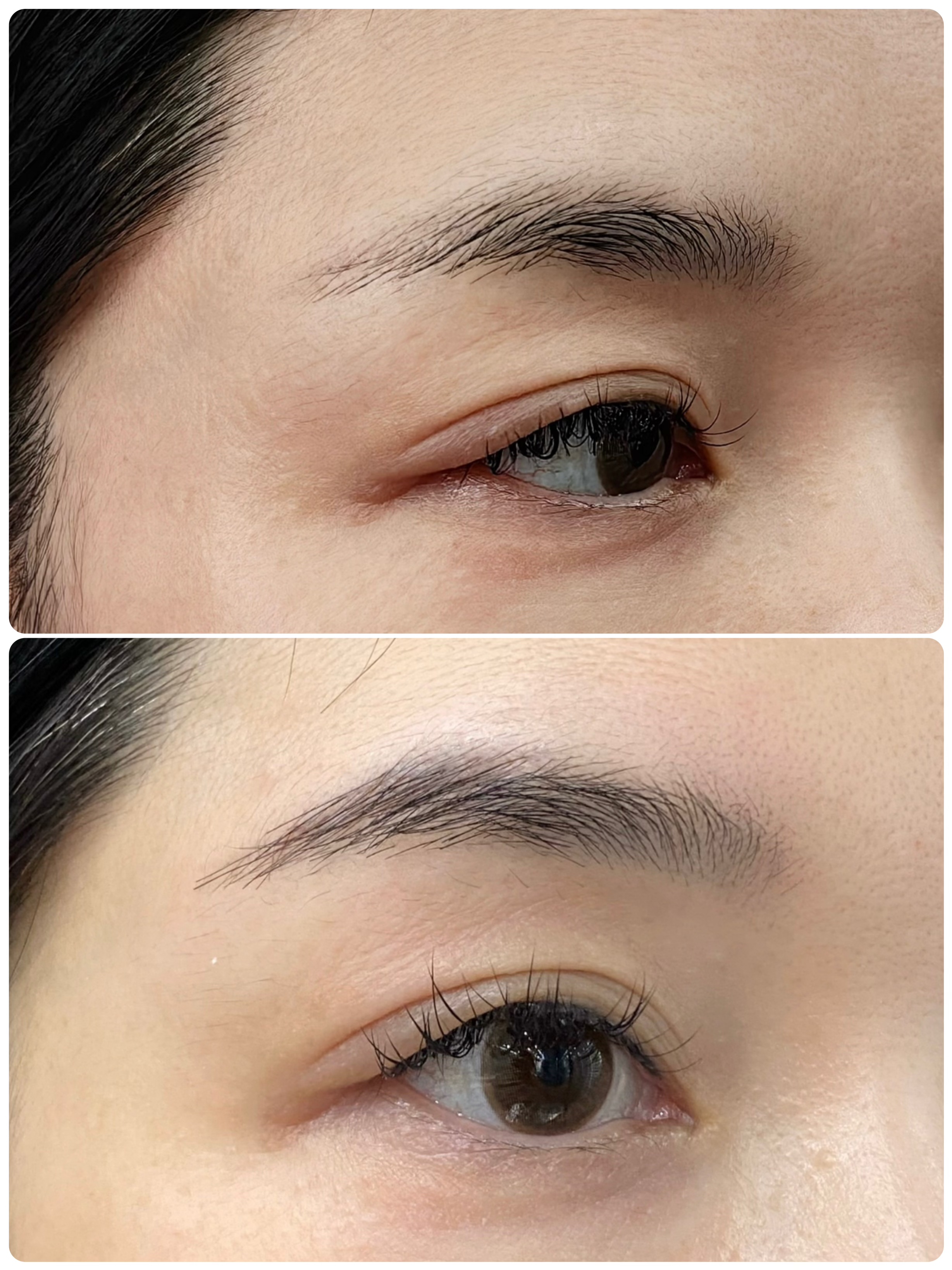 植绣眉毛蛋白真人毛发真眉大师ai原生克隆眉无排斥男女士种植眉毛