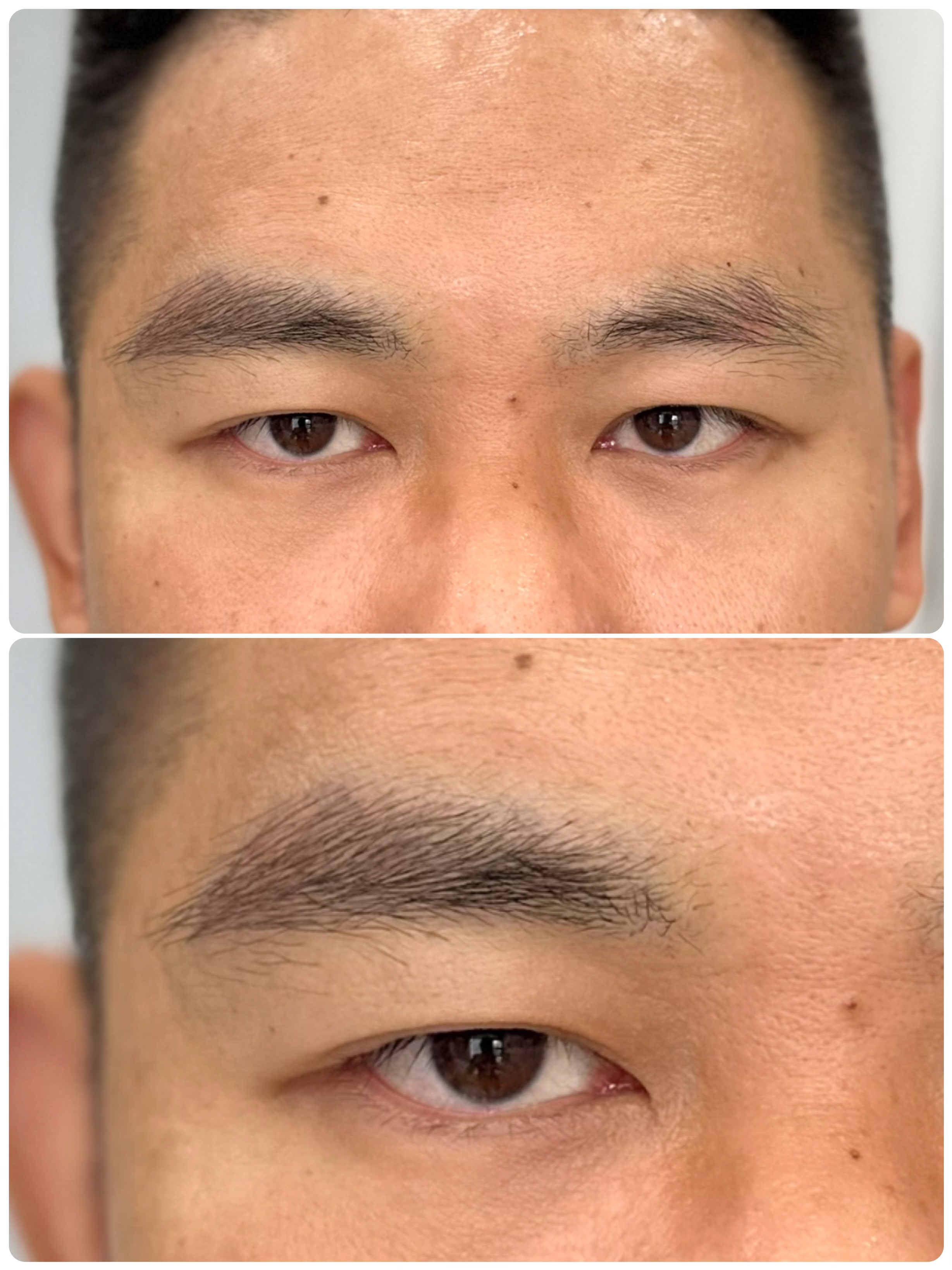 植绣眉毛蛋白真人毛发真眉大师ai原生克隆眉无排斥男女士种植眉毛