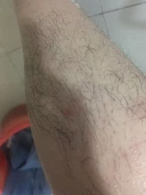 天生腿上就是毛茸茸的， 各种脱毛蜜蜡，脱毛膏都用过了，越来越长， 最后在小红书种草，终于狠下心买了丝芙乐这款脱毛仪， 优点是安全认证激光脱毛，缺点出光口太小了，而且有时候看不到打在哪里， 期待后续使用