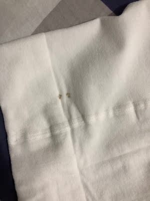 买之前看了评论,所以收到后先检查了一下,果不其然有问题哈,有几个像是洗不掉的黑斑,没敢动,想着我啥也没动给我退换一下也不过分的心态,没想到这种问题在客服眼里都不是质量问题,那我只能说这东西很差并给个差评了。 买之前看了评论,所以收到后先检查了一下,果不其然有问题哈,有几个像是洗不掉的黑斑,没敢动,想着我啥也没动给我退换一下也不过分的心态,没想到这种问题在客服眼里都不是质量问题,那我只能说这东西很差并给个差评了。