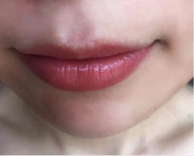 昨天试了试，有点效果。包装精致。物流很快。店家态度很好。下次用完再来买。