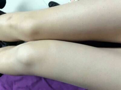 不得不说效果太强大了，我老公都快被我迷醉了，哈哈，而且效果也真的很明显哦，现在非常粉嫩，对比以前真的感觉差别好大。变粉嫩了，老公开心我也开心，每个女人都是爱美丽的，点赞，看得见的效果才是好东西。