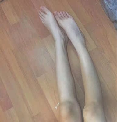 宝贝刚收到的时候，也没想到效果会有这么好，每天都在用，黑色素每天都会在慢慢淡化掉呢，之前买过其他牌子，就像变色口红一样，涂上去是会变粉，特别的粉，但是洗掉又变回原来的样子，后来换了这个牌子的宝贝，虽然改变不是很快，但是洗掉也不会反弹，真的不错，很喜欢。效果真的好，用到的地方都白了很多呢，还推荐朋友来买了呢。