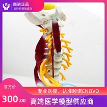 ENOVO Yinuo Medical Human Cervical Model Brachial Plexus Neuromuscular Model Human Bone Specimen Model Atlanto