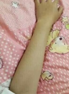 这款脱毛膏真的太好了，看朋友用别的脱毛膏脱毛贴感觉好痛流血了都，所以一直都不敢用，这次看评论都说不痛而我是那种敏感皮肤怕过敏，红痒，用过以后完全没有这个反应，可以放心使用，现在我手臂，大腿和腋下那些让人困扰的长毛全部都脱干净了，整个人都感觉清爽了很多。