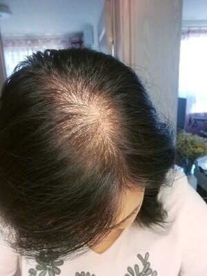 假发片女真人发丝遮白发增发量蓬松自然隐形无痕一片式头顶补发块