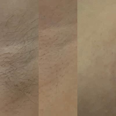 吐槽闺蜜推荐的ulike蓝宝石脱毛仪怎么样,是否真的那么好用神奇