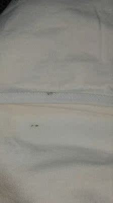 衣服都长霉了;你们看看 衣服都长霉了;你们看看