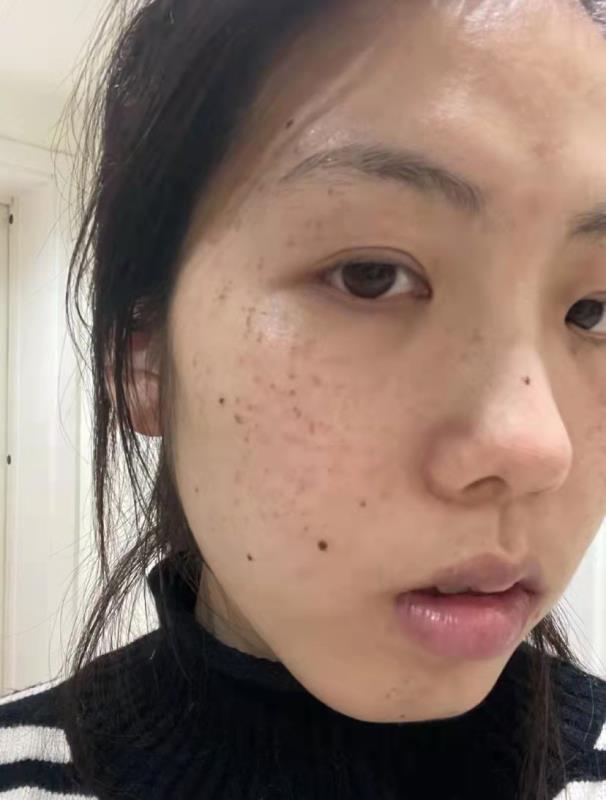 男人用什么祛斑效果最好,男士美白淡斑护肤品效果好