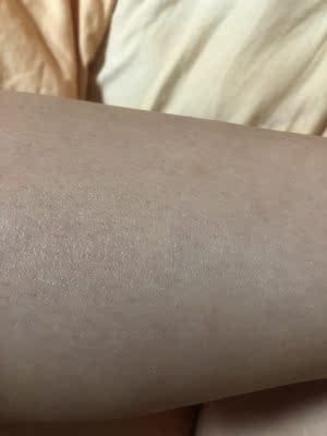 点评绝不偏颇的对比可思美和ulike哪个好，到底哪款真正好用？