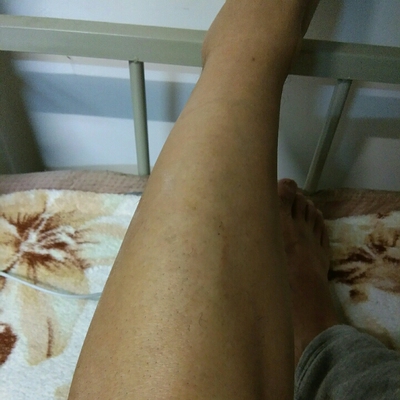 刚才用了效果不错