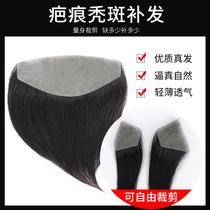 Biofilm Scar Wig Cover Head Scar Scar Surgery Scar Small Area True Hair Repair Block Cut