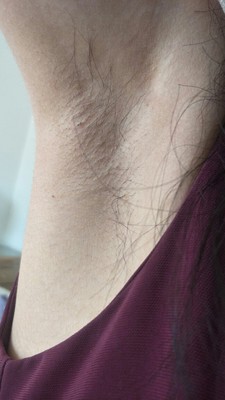 不错，效果挺好的，温和不刺激，没有异味，去毛很干净，价格实惠，物美价廉，轻松去毛。朋友推荐我买的，开始我也是抱着试试的心态，没想到效果这么好，真的挺好用的，而且价位还便宜。现在皮肤变好了很多，无毛而且变白了，是能看到毛毛生长变慢的，抑毛效果看的见，用完会再来的。