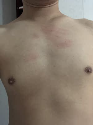 有刺激性，容易过敏，下次不会买了