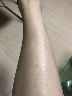 如何评价男生用脱毛仪慕金muse和gold哪款好？哪个效果更好用的？