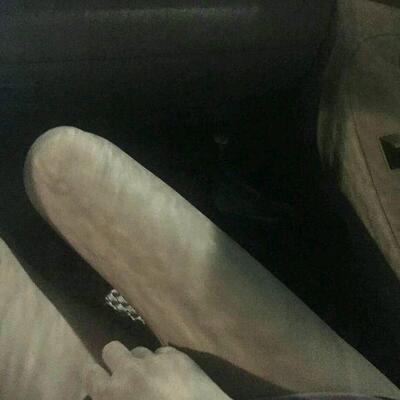 使用了一段时间以后乳房的深色现在变得浅太多太多了，下体也是变浅好多了，但是待完美还得有一段时间，加油继续使用中。真的有效果，但必须要坚持使用才会有效果的哦，会继续用的，希望能把产品越做越好。就是包装看着不怎么好看，很一般。