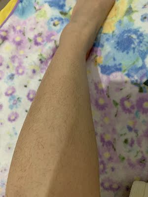 吐槽偶然看到朋友用的丝可silkn Infinity 2.0脱毛仪怎么样？说说