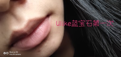 分析夏天用木薯冰感脱毛仪T3怎么样，对皮肤有影响吗？分享！