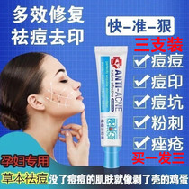 Research Spring Hall Pimple Acne Print Youthful Pimple Pit Repair Play down Acne Scars for men and women to close mouth acne students