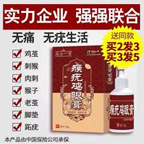 Chicken Eye Ointment Chicken Eye Ointment Chicken Eye Paste Toe to Wuring Yunnan Herb Ointment