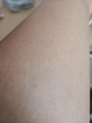 调查心得目前很火的歌岚脱毛仪怎么样,脱毛效果到底好不好?给力