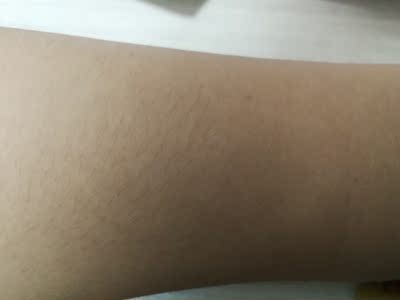 博朗AI小闪电激光脱毛仪PL3011质量合不合格，不参考后悔呀