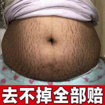 Go to gestational tattoo pregnant women to prevent special repair cream eliminates Hautchen compact postpartum tummy to prevent obesity