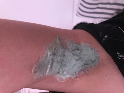 脱了腋下的毛，腋下毛很粗长，忘记修剪了，但是幸亏菲妈教我怎么撕下来，第一次使用蜜蜡还是很顺利的，脱完很干净，没有根留着，很爽，会无限回购