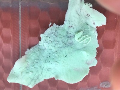 把私处的毛都处理干净了，真的很爽，之前用了脱毛膏，走路都觉得很扎，很难受，这个脱了没有黑根的，应该能保持很久，送的工具比较齐全，菲妈很耐心的告诉方法，值得推荐