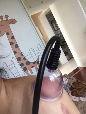 产品很好用,身体湿气重,用后身体轻松多了,原来身体到处痛,不能在空调房里,身体里好像有虫子爬一样,用了三天后现在好多了。谢谢阿迪科特产品。另外店家与客服都很耐心,不怕麻烦的怎么使用一 产品很好用,身体湿气重,用后身体轻松多了,原来身体到处痛,不能在空调房里,身体里好像有虫子爬一样,用了三天后现在好多了。谢谢阿迪科特产品。另外店家与客服都很耐心,不怕麻烦的怎么使用一