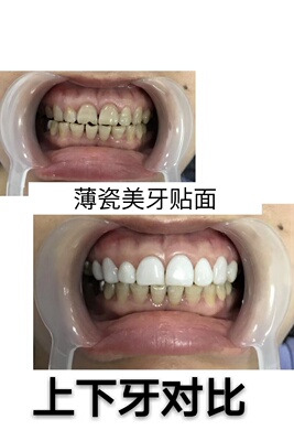 特别喜欢,样子很好看的保守又性感,另外牙齿美白联系我 特别喜欢,样子很好看的保守又性感,另外牙齿美白联系我