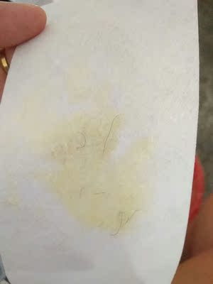 个人情况: 我觉得还是比较正常的，有一点点多，。。。。。。。。。。。。。。看图吧 使用效果: 撕了几次了，看图吧，我以前在店里面也撕过的，，，一下就没了，很干净，挑了那么多家，还是这样，没办法了，真不知道好评是怎么来的 特别说明: 。。。。。。。。。。。。。！。。。。。。。。。。。。。。。。。。。。。。。。。。 