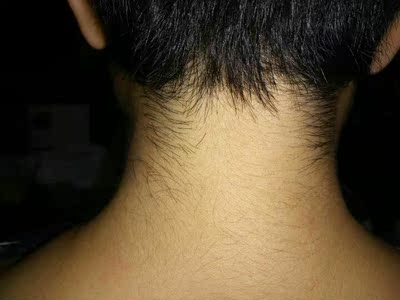 脖子后面绒绒毛太多了，每次剪头发才刮一次，长出来太难看了，还好买了这瓶脱毛膏，自己随时都可以脱，简单方便好用。