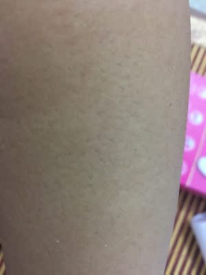 用了三周，毛长慢了，而且局部已经不长了，但是窗口小，不能全部对好，只能多用让局部多接触了