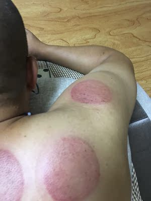 机器很好用,和美容院的效果差不多, 机器很好用,和美容院的效果差不多,