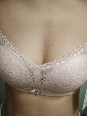 晚上回家就试了一下，第一张是没扣扣子的，后面的是扣上的效果，效果不错，挺满意的