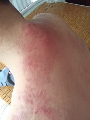 很实惠的宝贝,实用,好用,棒棒的!给妈妈做的拔罐! 很实惠的宝贝,实用,好用,棒棒的!给妈妈做的拔罐!