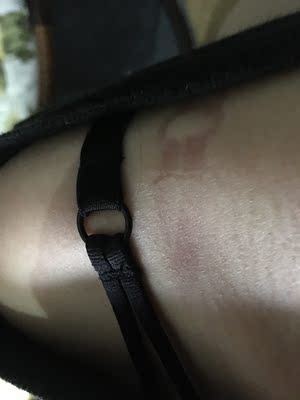 带子并没有系很紧的情况下，还能勒成这样，甚买