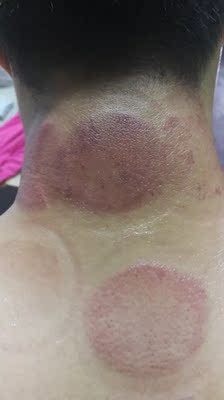 仪器挺好的,和美容院的没有什么区别,需要的赶紧下手哦! 仪器挺好的,和美容院的没有什么区别,需要的赶紧下手哦!