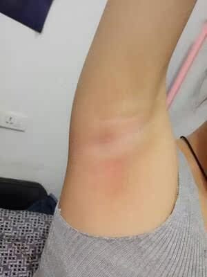 私处专用的，就是要专用的才好用嘛，脱毛膏是白色的液体，附送了一个白色的小刮板，客服也是很有耐心的，脱的也很干净。赞。