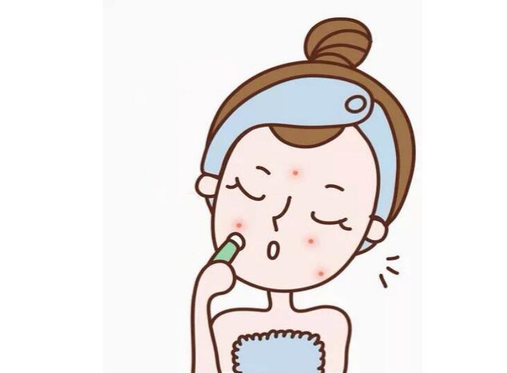祛痘需要注意什么?不懂就不要乱挤了