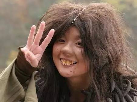 十位女星惨遭毁容!最丑明星排行