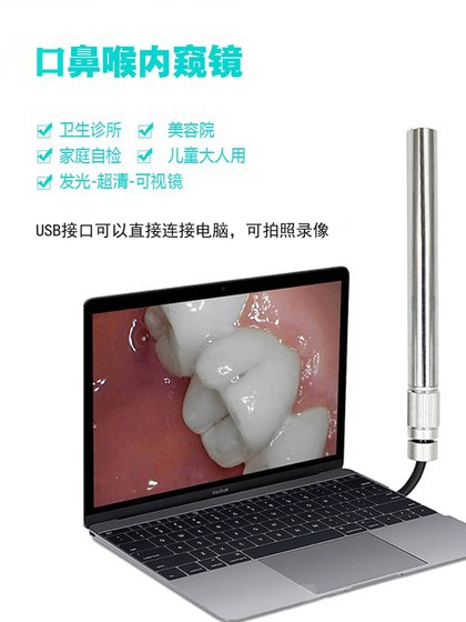 HD 내시경 USB voyeuroscope 전자 시각 미러 피부 미용 질 항문 교회 개인 가정 관리 HD 내시경 USB voyeuroscope 전자 시각 미러 피부 미용 질 항문 교회 개인 가정 관리